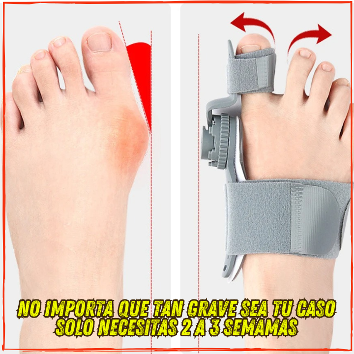 ✅Corrector de Juanetes Ortopedico✅ Para mujeres y Hombres